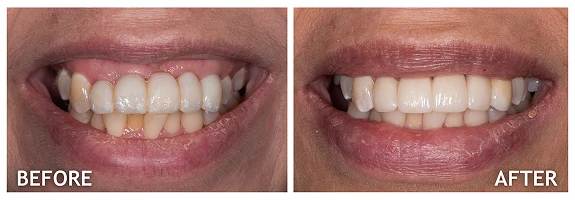 Before and After photos