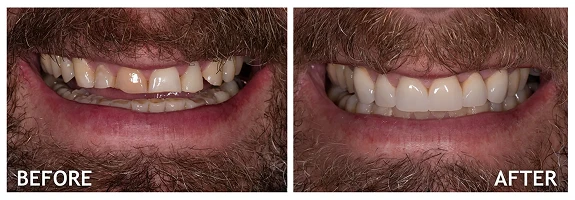 Before and After photos