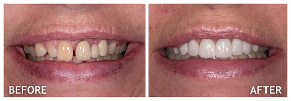 Before and After photos