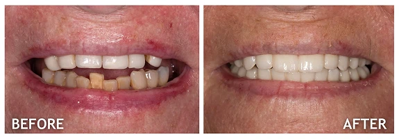 Before and After photos