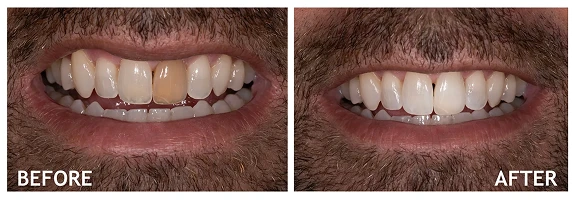 Before and After photos