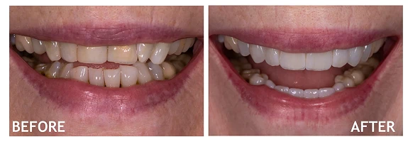 Before and After photos