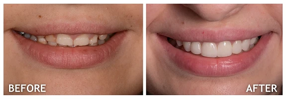 Before and After photos